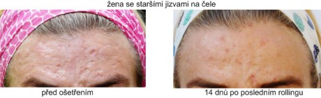 cosmetics_mezoterapie10